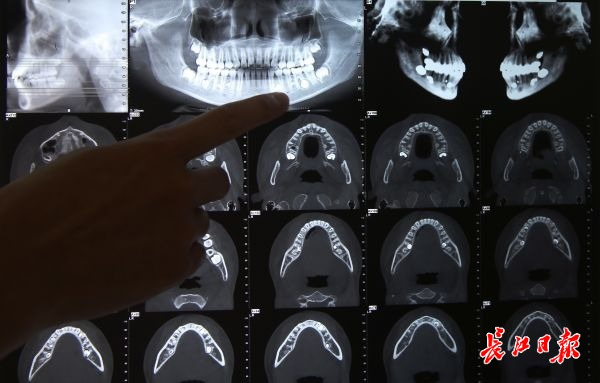 点击查看高清原图